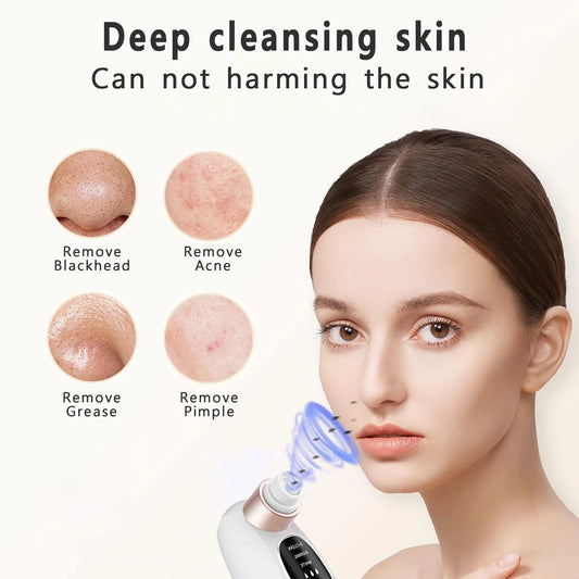 Blackhead Remover Pore Vacuum Face Cleaner