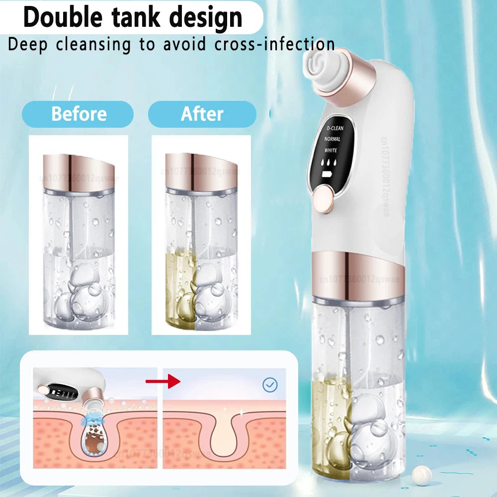 Blackhead Remover Pore Vacuum Face Cleaner