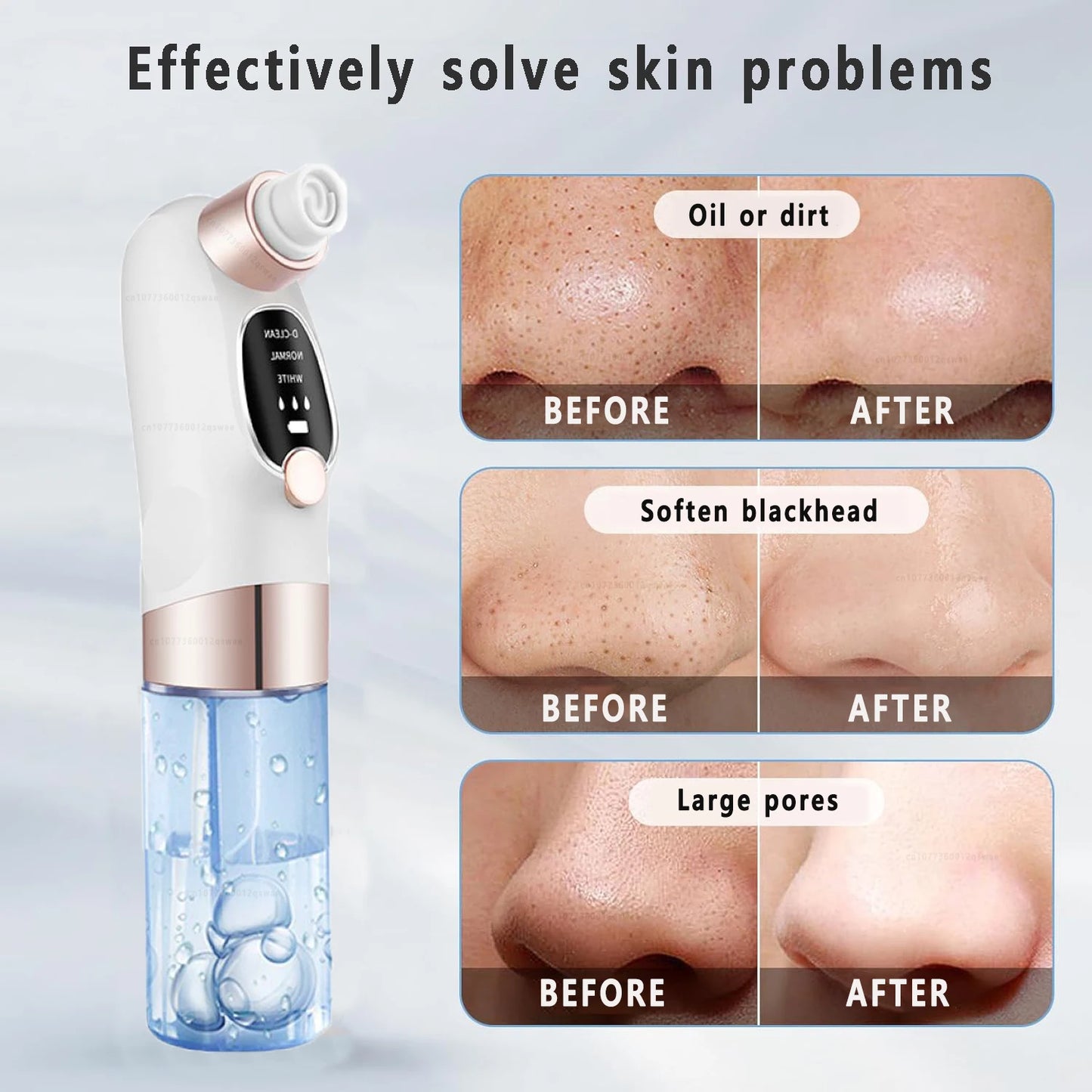 Blackhead Remover Pore Vacuum Face Cleaner